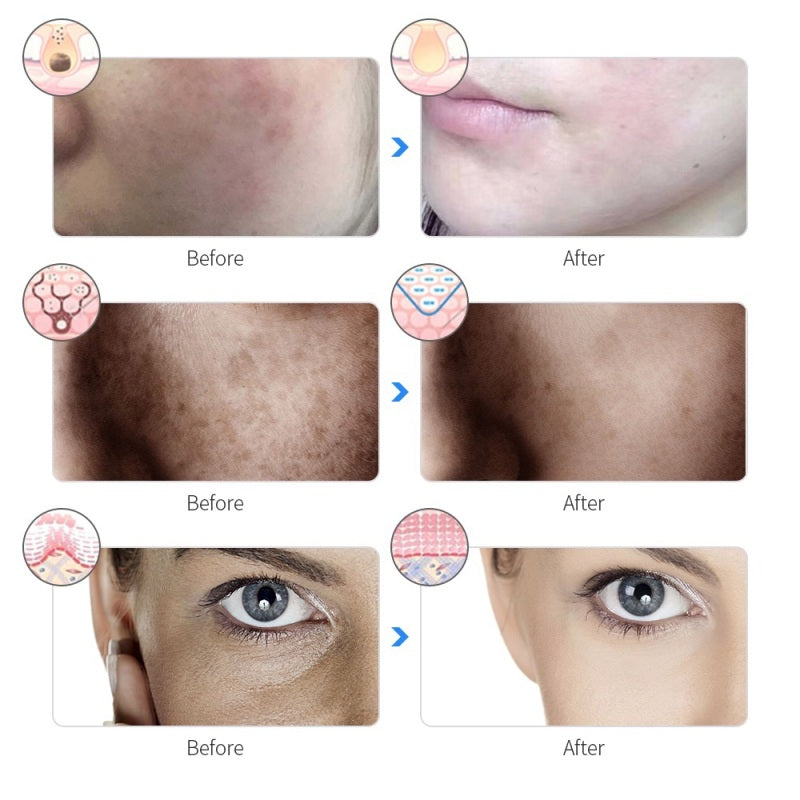 LED Face Mask Light Therapy
